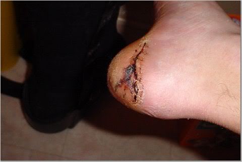 Name:  foot.jpg
Views: 48
Size:  15.1 KB