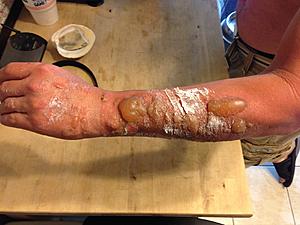 Mandatory Factory Option: Fire Extinguisher-burn.jpg